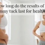 How Long Do the Results of a Tummy Tuck Last