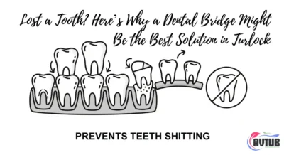 Lost a Tooth? Here’s Why a Dental Bridge Might Be the Best Solution in Turlock
