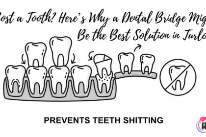Lost a Tooth? Here’s Why a Dental Bridge Might Be the Best Solution in Turlock