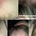 Red Bumps on Back of Neck and Upper Back: Causes & Fixes
