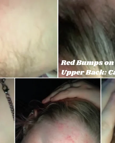 Red Bumps on Back of Neck and Upper Back: Causes & Fixes