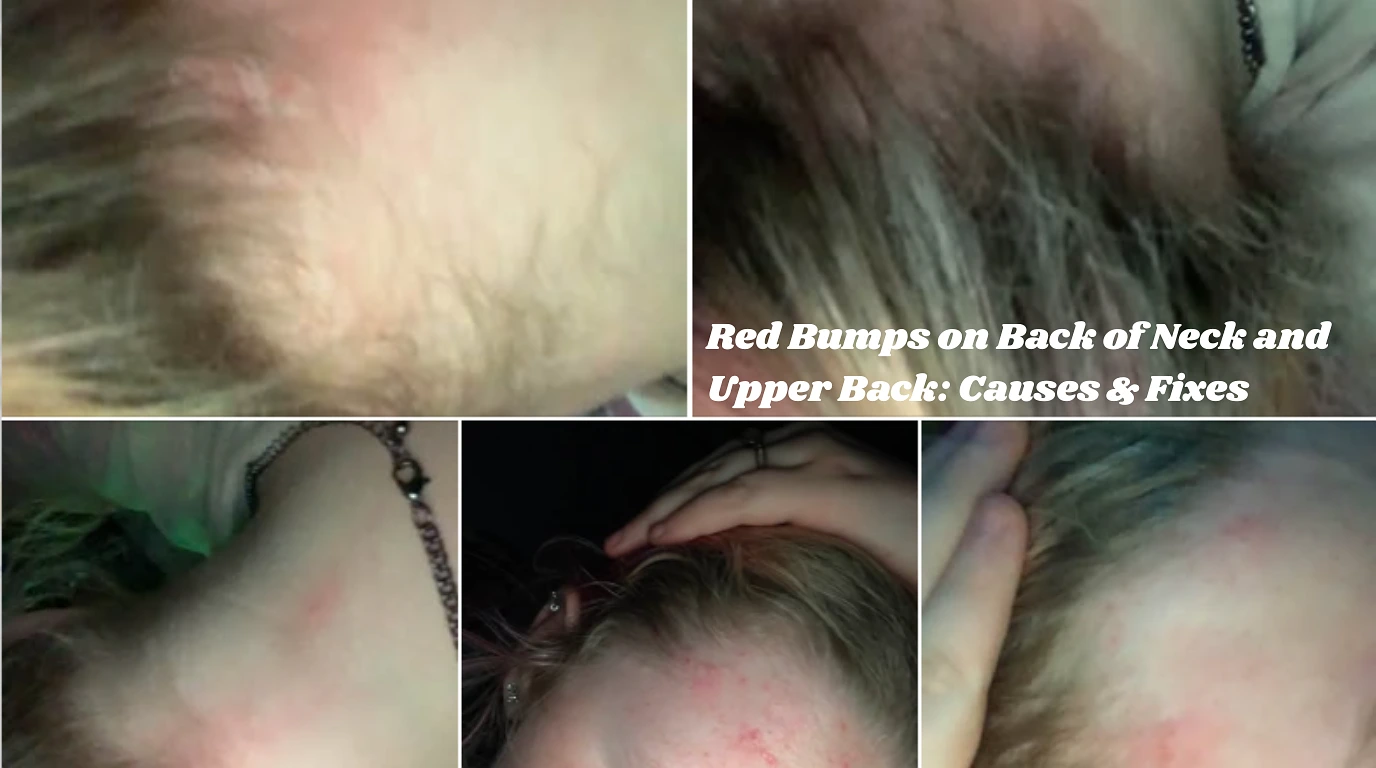 Red Bumps on Back of Neck and Upper Back: Causes & Fixes