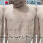 Zelsuvmi for Molluscum: How Long to Use It and When Redness Means Stop